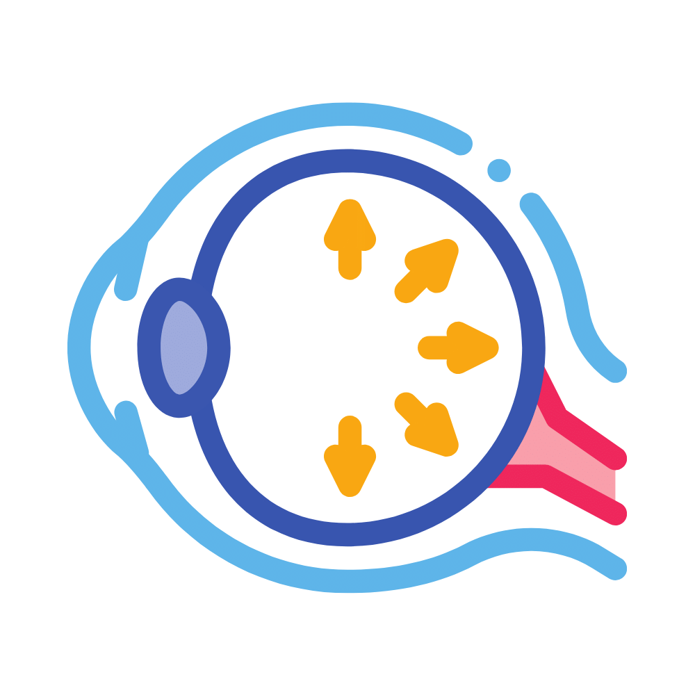 ilustração de olho com glaucoma