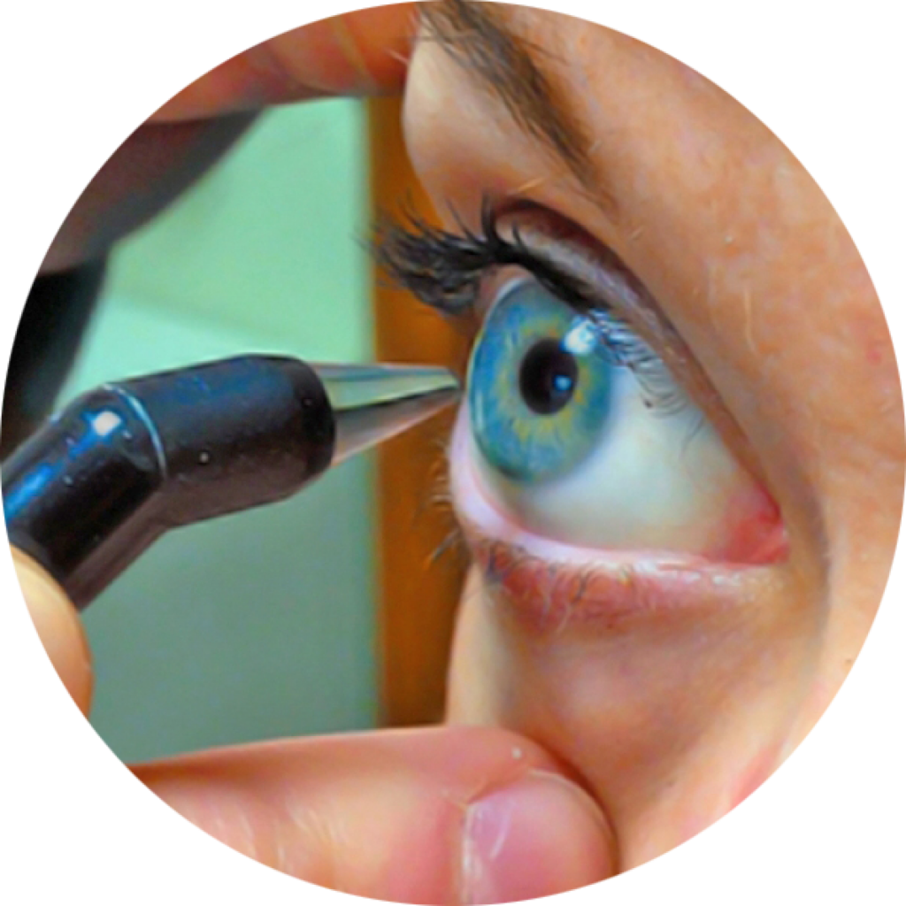Exame de paquimetria ultrassônica ocular