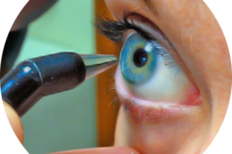 Exame de paquimetria ultrassônica ocular