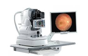 Aparelho que realiza o exame de angiografia fluoresceínica ou retinografia fluorescente
