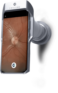 Retinógrafo portátil