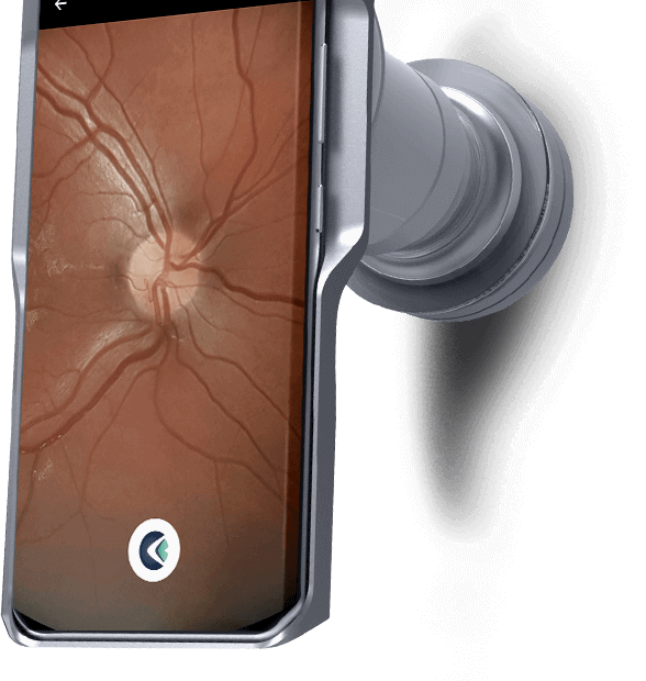 Retinógrafo portátil