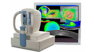 exame-de-oct-ou-tomografia-de-coerencia-optica